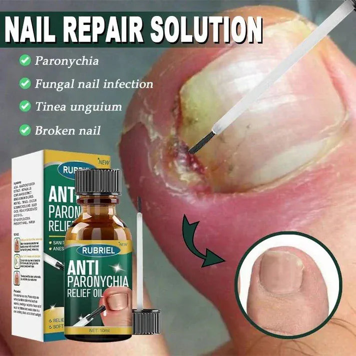 Anti Paronychia Relief Oil (Buy 1 Get 1 FREE)
