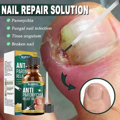 Anti Paronychia Relief Oil (Buy 1 Get 1 FREE)