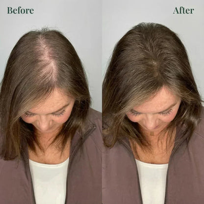Kerarose Rosemary Shampoo For Hair Growth ( Buy 1 Get 1 Free 🔥)