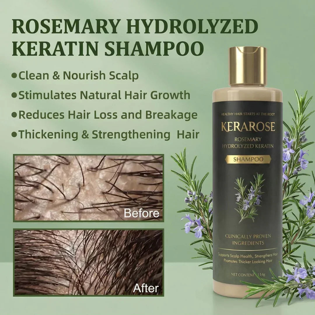 Kerarose Rosemary Shampoo For Hair Growth ( Buy 1 Get 1 Free 🔥)