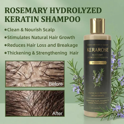 Kerarose Rosemary Shampoo For Hair Growth ( Buy 1 Get 1 Free 🔥)